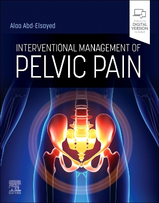 Interventional Management of Pelvic Pain book