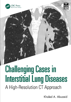Challenging Cases in Interstitial Lung Diseases: A High-Resolution CT Approach by Khaled A. Abuzeid