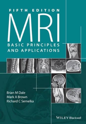 MRI Basic Principles and Applications, 5E book