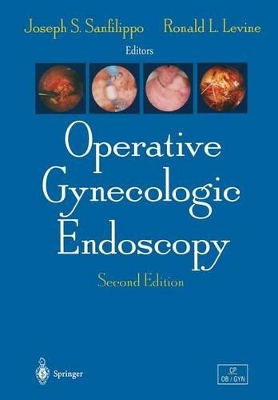 Operative Gynecologic Endoscopy book
