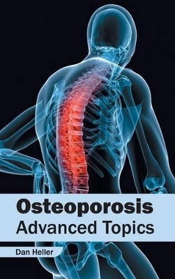 Osteoporosis book