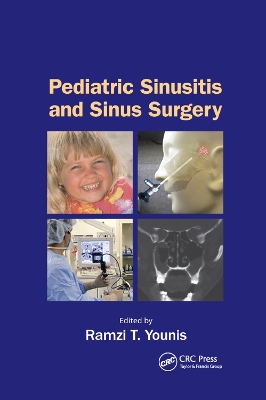 Pediatric Sinusitis and Sinus Surgery book