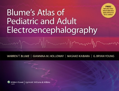 Blume's Atlas of Pediatric and Adult Electroencephalography book