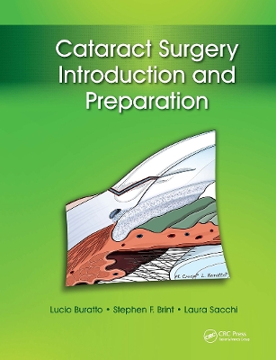 Cataract Surgery book