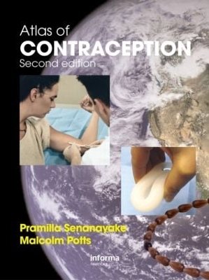 Atlas of Contraception book