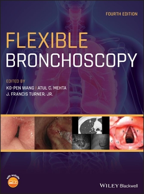 Flexible Bronchoscopy by Ko–Pen Wang