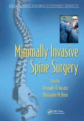 Minimally Invasive Spine Surgery by Alexander R. Vaccaro