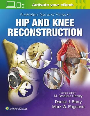 Illustrated Tips and Tricks in Hip and Knee Reconstructive and Replacement Surgery book