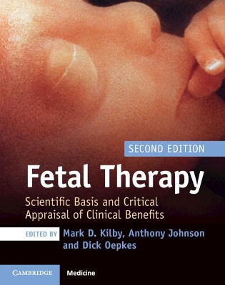 Fetal Therapy: Scientific Basis and Critical Appraisal of Clinical Benefits by Mark D. Kilby