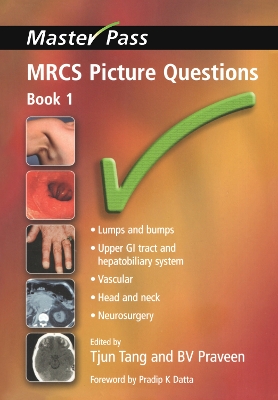 MRCS Picture Questions: Bk. 1 book