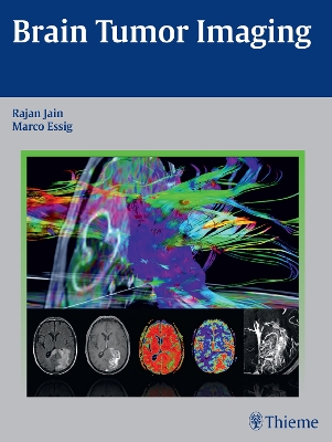 Brain Tumor Imaging book