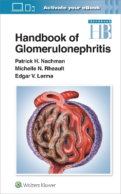 Handbook of Glomerulonephritis book