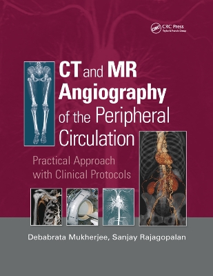 CT and MR Angiography of the Peripheral Circulation: Practical Approach with Clinical Protocols book