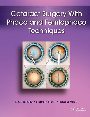 Cataract Surgery with Phaco and Femtophaco Techniques by Lucio Buratto