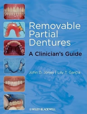Removable Partial Dentures book