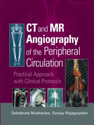 CT and MR Angiography of the Peripheral Circulation by Debabrata Mukherjee