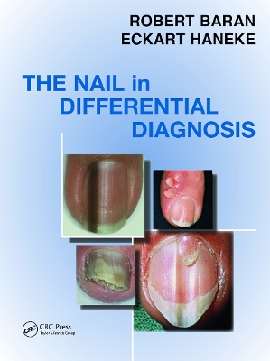 Nail in Differential Diagnosis book