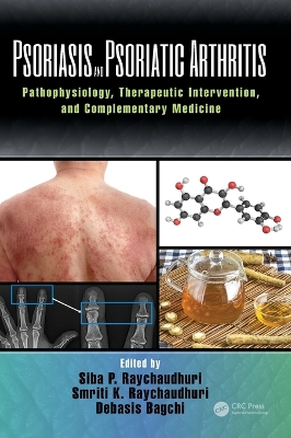 Psoriasis and Psoriatic Arthritis by Debasis Bagchi