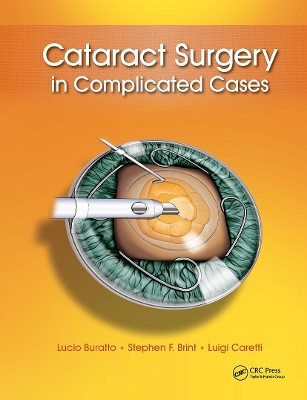 Cataract Surgery in Complicated Cases book