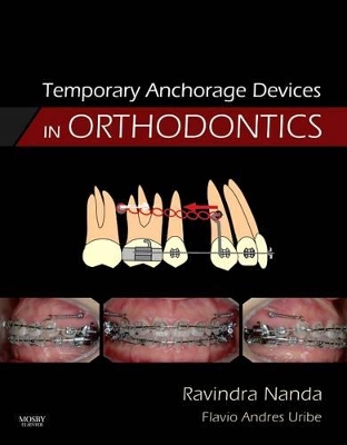 Temporary Anchorage Devices in Orthodontics book