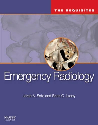 Emergency Radiology by Jorge A Soto