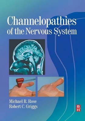 Channelopathies of the Nervous System book
