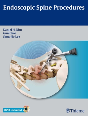 Endoscopic Spine Procedures book