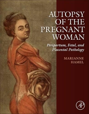 Autopsy of the Pregnant Woman: Peripartum, Fetal, and Placental Pathology book