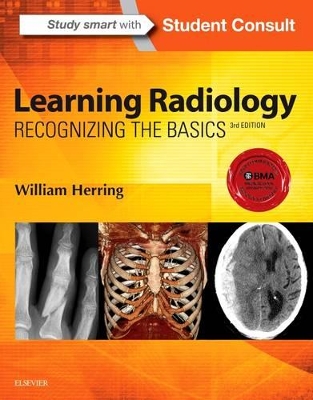 Learning Radiology by William Herring