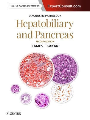 Diagnostic Pathology: Hepatobiliary and Pancreas book