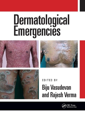 Dermatological Emergencies by Rajesh Verma