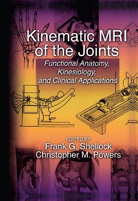 Kinematic MRI of the Joints book