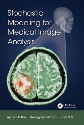 Stochastic Modeling for Medical Image Analysis by Ayman El-Baz