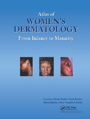 Atlas of Women's Dermatology book