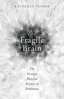 Fragile Brain book