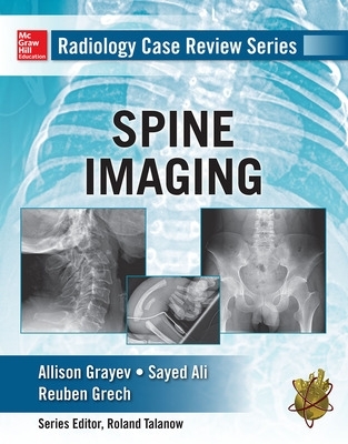 Radiology Case Review Series: Spine book
