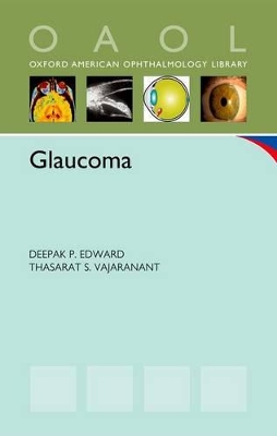Glaucoma book