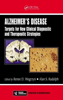 Alzheimer's Disease book