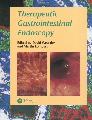Therapeutic Gastrointestinal Endoscopy book