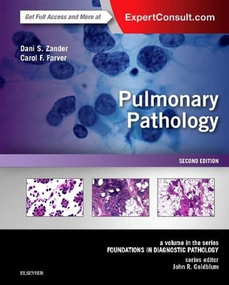 Pulmonary Pathology by Dani S. Zander