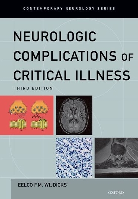 Neurologic Complications of Critical Illness by Eelco F.M. Wijdicks