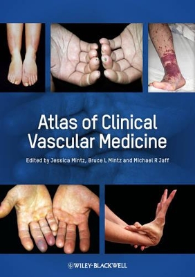 Atlas of Clinical Vascular Medicine book