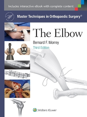 Master Techniques in Orthopaedic Surgery: The Elbow book