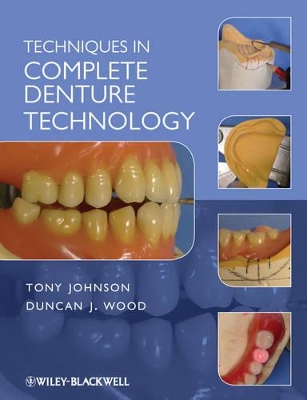 Techniques in Complete Denture Technology book