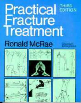 Practical Fracture Treatment by Ronald McRae