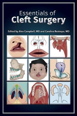 Essentials of Cleft Surgery book