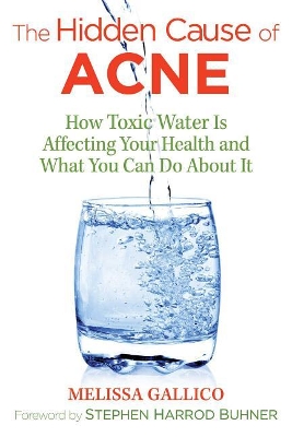 Hidden Cause of Acne book