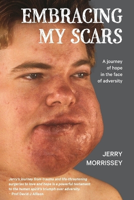 Embracing My Scars: A journey of hope in the face of adversity book