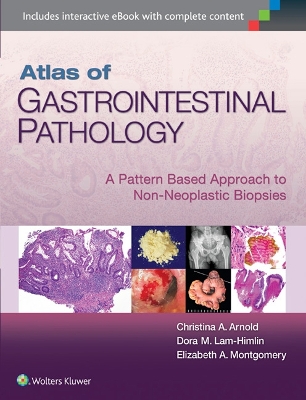 Atlas of Gastrointestinal Pathology book
