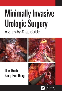 Minimally Invasive Urologic Surgery: A Step-by-Step Guide book